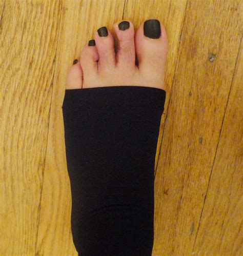 My Toe Shortening Surgery And Hammertoe Hammer Toe Surgery Blog