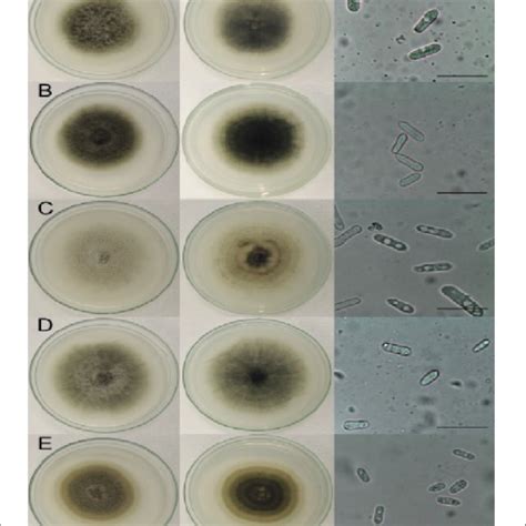 Colony Morphology And Conidial Shape Of Colletotrichum Species