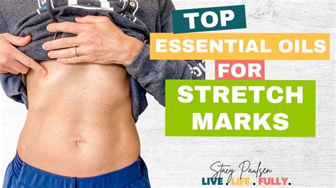 Essential Oils For Stretch Marks How To Prevent And Get Rid Of Youtube