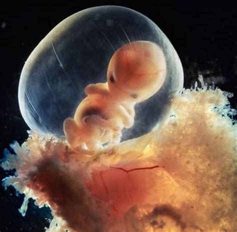 These Photos Perfectly Capture The Stages Of Baby Development Before