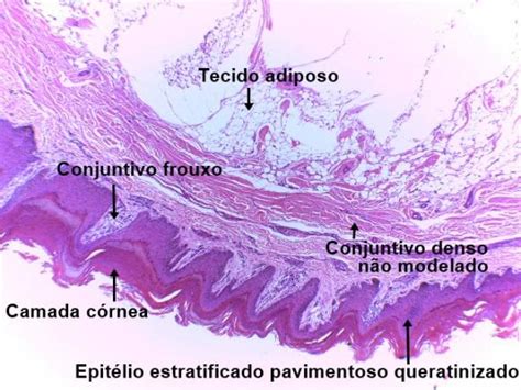 Tecido Epitelial De Revestimento Histologia E Embriologia