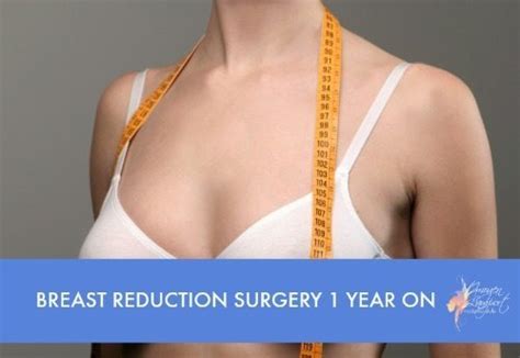 Breast Reduction Update 1 Year On Inside Out Style