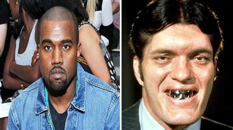 Kanye West Gets 850k Titanium Dentures Modeled After James Bond Spyby