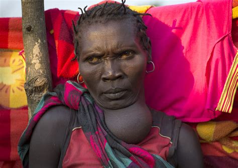 Majang Tribe Woman With Goitre Kobown Ethiopia © Eric L Flickr