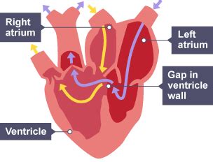 When the atrium is full, it pumps blood to a second chamber, the ventricle. Class Sauropsida - Angelena Mangieri