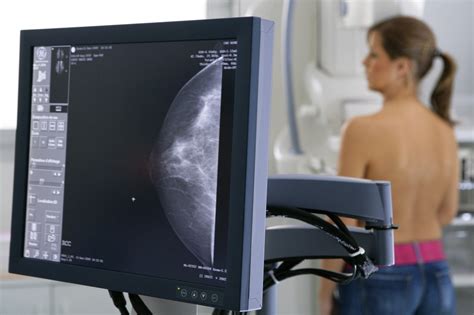 u s to require breast density information after mammograms pbs newshour