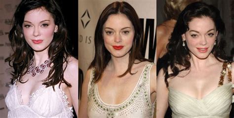 Rose Mcgowan Plastic Surgery Before And After Pictures 2018