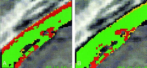 Automatic Method To Assess Local Ctmr Imaging Registration Accuracy On