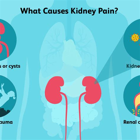 Are The Kidneys Located Inside Of The Rib Cage What Is Kidney Cancer