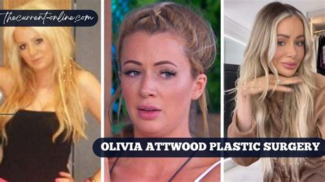 Olivia Attwood Plastic Surgery Her Wild Transformation How Different