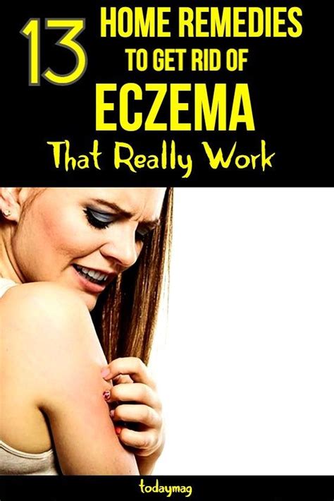 13 Home Remedies To Get Rid Of Eczema Fast That Really Work Get Rid