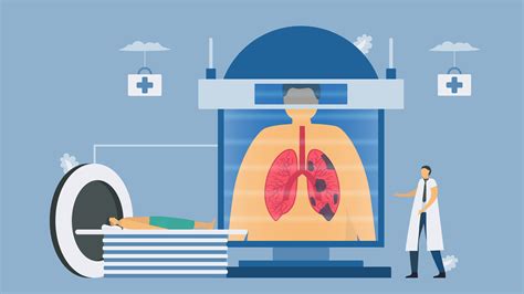 Sistemas De Tomografia Computadorizada Para Teste De Doen A Pulmonar Obstrutiva Cr Nica