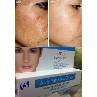 In order to get the maximum result. Vincere Anti-melasma Cream 15 ml. - Buy Online in UAE ...