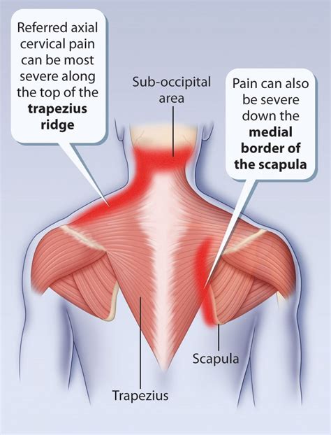 Got Shoulder Pain Don’t Be Surprised If Your Massage Therapist Starts Working On Your Neck