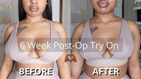 BREAST REDUCTION Before And After Try On 6 Week Post Op Luxury Tot
