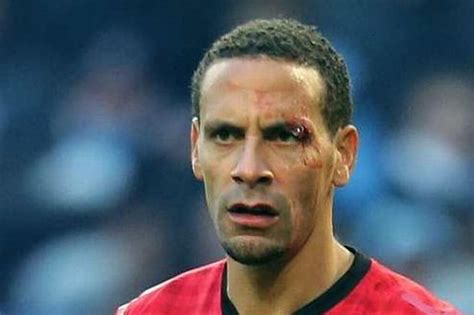 Police Appeal To Find Yob Who Threw Coin That Injured Rio Ferdinand At