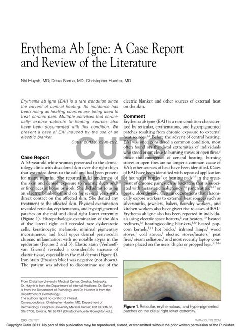 Erythema Ab Igne A Case Report And Review Of The Literature Docslib