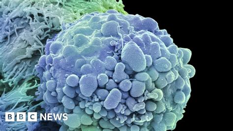 Softener May Help Kill Cancers Bbc News
