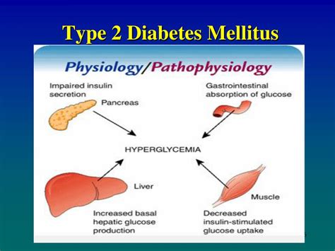 Ppt Chapter 41 Assessment And Management Of Patients With Diabetes