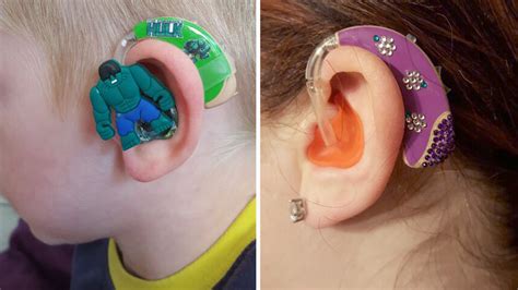 Inspired By Partially Deaf Son Mom Sells Hearing Aids For Kids