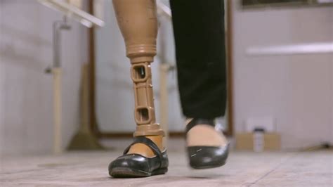 Manufacturing Cheap And Highly Portable Prosthetic Limbs Britannica