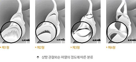 천안센텀정형외과신경외과병원