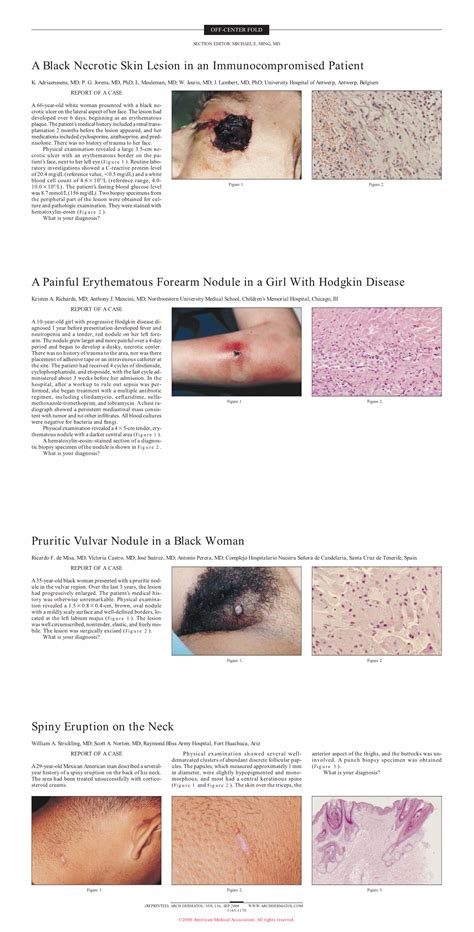 Pruritic Vulvar Nodule In A Black Woman Jama Dermatology Jama Network
