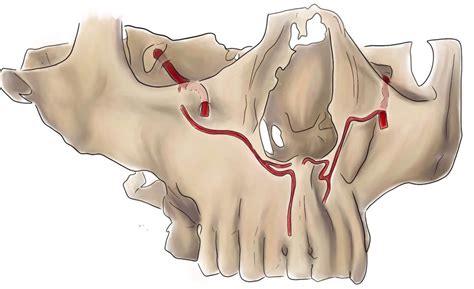 Canalis Sinuosus Anatomy And Variation News Dentagama