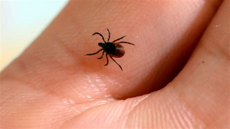 Lyme Group Expects Bad Tick Year In Manitoba Manitoba Cbc News