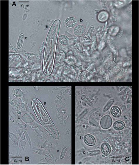 Chiropsella Bronzie Gershwin 2006 Sp Nov Plazi Treatmentbank