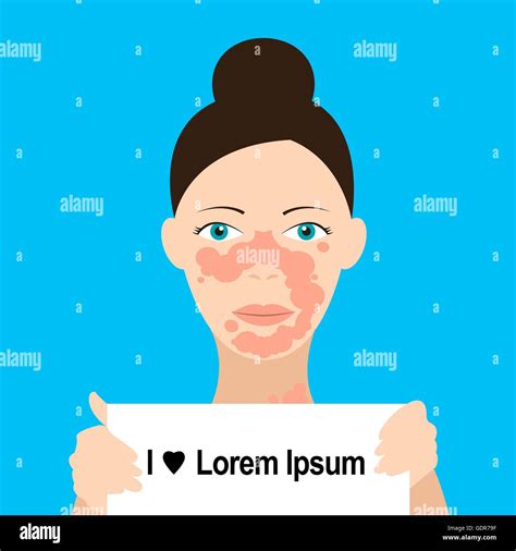 Skin Problems Vector Illustration Stock Vector Image And Art Alamy