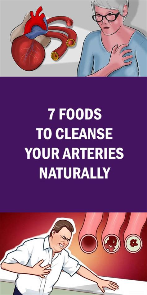 7 Foods To Cleanse Your Arteries Naturally With Images Natural Health Remedies