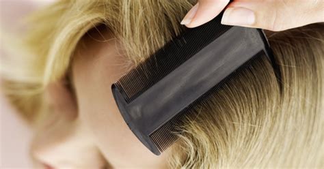 Old Folk Remedies To Kill Hair Mites Ehow Uk