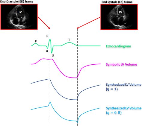 End Diastolic Ed And End Systolic Es Frames With Corresponding