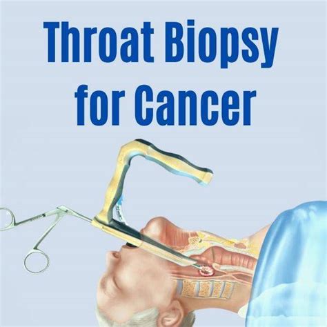 Throat Cancer Detection