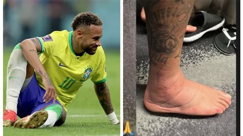 Neymar Muestra Su Tobillo Inflamado En El Mundial De Catar 2022