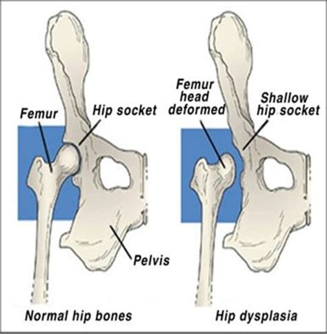 A Simple Guide To Hip Dysplasia In Dogs Pethelpful