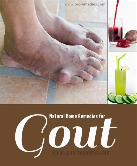 Natural Home Remedies For Gout Home Remedies For Gout Natural Home