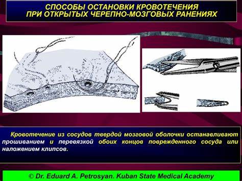Диета при желудочно кишечного кровотечения Диета при желудочно кишечного кровотечения