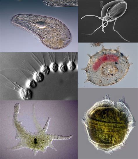 4 main groups of protozoa protists scanning electron micrograph microbiology