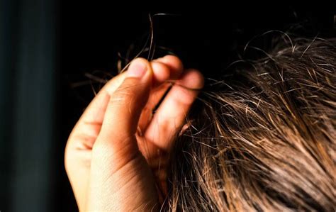 Unusual Types Of Hair Loss Trichotillomania Capillus