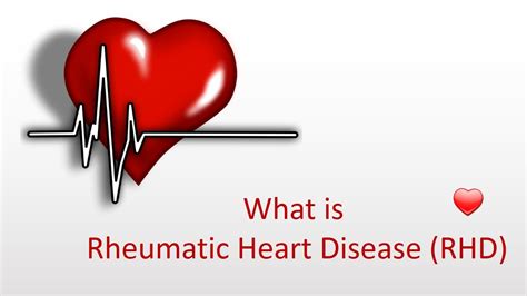 What Is Rheumatic Heart Disease Rhd Youtube