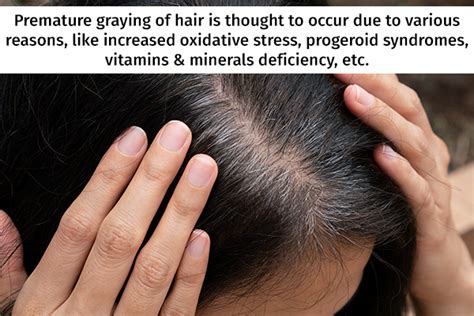 Premature Graying Of Hair Possible Causes And Treatments