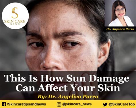This Is How Sun Damage Can Affect Your All Layer Skin