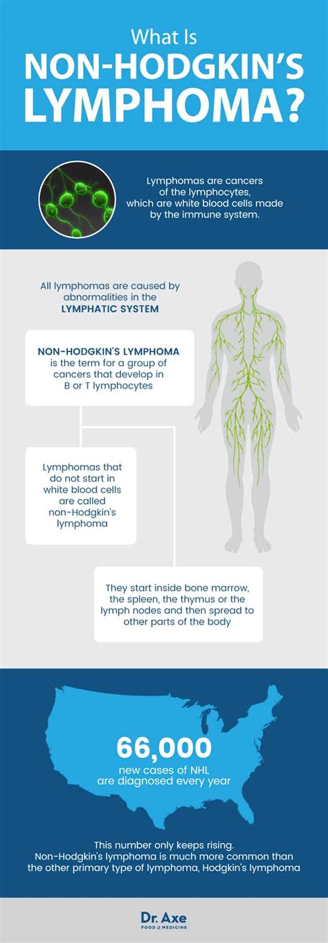 An unusual case of tattoo pigment hypersensitivity caused widespread lymphadenopathy 15 years later, but without a skin reaction. Non-Hodgkin's Lymphoma: Natural Symptom Management - Dr. Axe