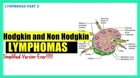 Lymphomas Made Easy Hodgkin Vs The Non Hodgkin Lymphomas Usmle