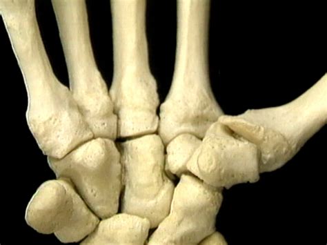Bones And Joints Of The Wrist And Hand Aclands Video Atlas Of Human