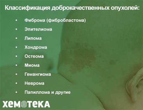 Доброкачественные опухоли и их характеристики - Хемотека Картинка - Доброкачественные опухоли и их характеристики - Хемотека