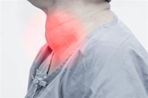 What Is Goiter And What Are Goiter Symptoms To Watch Out For