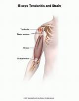 Images of Medical Treatment For Tendonitis